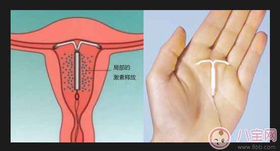 上环后什么时候可进行性生活 女性上环的最佳时期